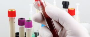Comment lire les résultats d’une prise de sang ?