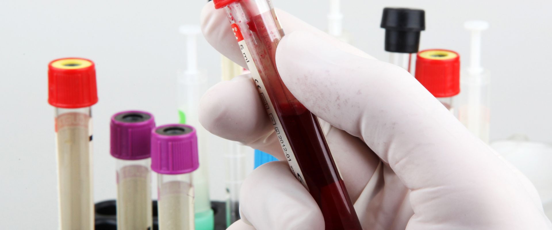 Lire la suite à propos de l’article Comment lire les résultats d’une prise de sang ?