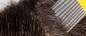 Poux : comment s’en débarrasser ?