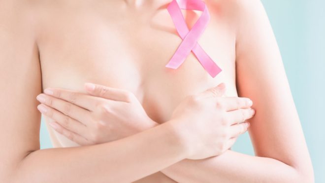 Tout savoir sur le cancer du sein