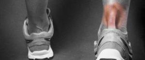 Lire la suite à propos de l’article Définition et causes des douleurs du talon